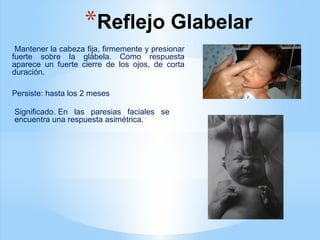 *Reflejo Glabelar
Mantener la cabeza fija, firmemente y presionar
fuerte sobre la glábela. Como respuesta
aparece un fuerte cierre de los ojos, de corta
duración.
Persiste: hasta los 2 meses
Significado. En las paresias faciales se
encuentra una respuesta asimétrica.
 