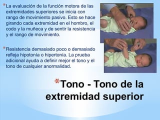 *Tono - Tono de la
extremidad superior
*La evaluación de la función motora de las
extremidades superiores se inicia con
rango de movimiento pasivo. Esto se hace
girando cada extremidad en el hombro, el
codo y la muñeca y de sentir la resistencia
y el rango de movimiento.
*Resistencia demasiado poco o demasiado
refleja hipotonía o hipertonía. La prueba
adicional ayuda a definir mejor el tono y el
tono de cualquier anormalidad.
 