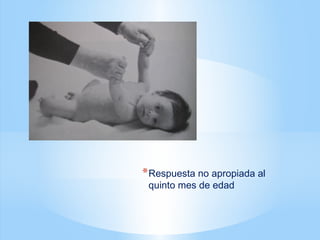 *Respuesta no apropiada al
quinto mes de edad
 