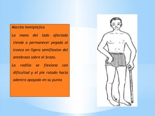 Marcha hemiplejica
La mano del lado afectado
tiende a permanecer pegada al
tronco en ligera semiflexion del
antebrazo sobre el brazo.
La rodilla se flexiona con
dificultad y el pie rotado hacia
adentro apoyado en su punta
 