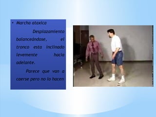 • Marcha ataxica
Desplazamiento
balanceándose, el
tronco esta inclinado
levemente hacia
adelante.
Parece que van a
caerse pero no lo hacen
 