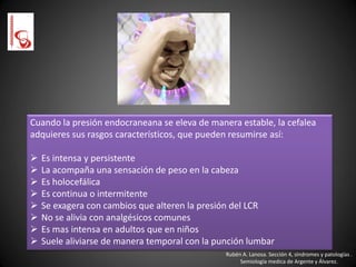 Rubén A. Lanosa. Sección 4, síndromes y patologías .
Semiología medica de Argente y Álvarez.
Cuando la presión endocraneana se eleva de manera estable, la cefalea
adquieres sus rasgos característicos, que pueden resumirse así:
 Es intensa y persistente
 La acompaña una sensación de peso en la cabeza
 Es holocefálica
 Es continua o intermitente
 Se exagera con cambios que alteren la presión del LCR
 No se alivia con analgésicos comunes
 Es mas intensa en adultos que en niños
 Suele aliviarse de manera temporal con la punción lumbar
 