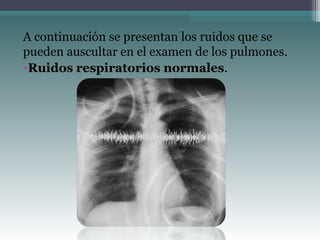 A continuación se presentan los ruidos que se
pueden auscultar en el examen de los pulmones.
•Ruidos respiratorios normales.
 
