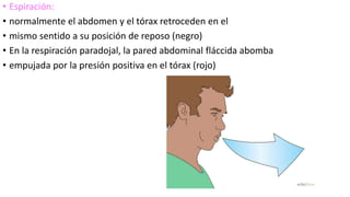 • Espiración:
• normalmente el abdomen y el tórax retroceden en el
• mismo sentido a su posición de reposo (negro)
• En la respiración paradojal, la pared abdominal fláccida abomba
• empujada por la presión positiva en el tórax (rojo)
 