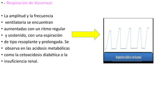 • - Respiración de Küssmaul:
• La amplitud y la frecuencia
• ventilatoria se encuentran
• aumentadas con un ritmo regular
• y sostenido, con una espiración
• de tipo resoplante y prolongada. Se
• observa en las acidosis metabólicas
• como la cetoacidosis diabética o la
• insuficiencia renal.
 