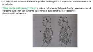 • Las alteraciones anatómicas torácicas pueden ser congénitas o adquiridas. Mencionaremos las
principales:
• Tórax enfisematoso o en tonel: la caja se deforma por la hiperinflación permanente en el
enfisema pulmonar, con aumento a predominio del diámetro anteroposterior
desproporcionadamente.
 