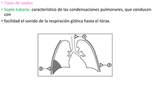 • Tipos de soplos
• Soplo tubario: característico de las condensaciones pulmonares, que conducen
con
• facilidad el sonido de la respiración glótica hasta el tórax.
 