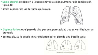 • Soplo pleural: o soplo en E , cuando hay relajación pulmonar por compresión,
típica del
• límite superior de los derrames pleurales.
• Soplo anfórico: es el paso de aire por una gran cavidad que es ventiladapor un
bronquio
• permeable. Se lo puede imitar soplando por el pico de una botella vacía
 