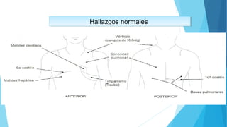 Hallazgos normalesHallazgos normales
 