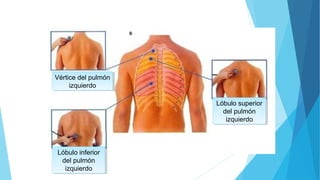 Vértice del pulmón
izquierdo
Vértice del pulmón
izquierdo
Lóbulo superior
del pulmón
izquierdo
Lóbulo superior
del pulmón
izquierdo
Lóbulo inferior
del pulmón
izquierdo
Lóbulo inferior
del pulmón
izquierdo
 