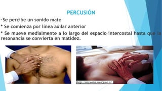 PERCUSIÓN
* Se percibe un sonido mate
* Se comienza por línea axilar anterior
* Se mueve medialmente a lo largo del espacio intercostal hasta que la
resonancia se convierta en matidez.
 