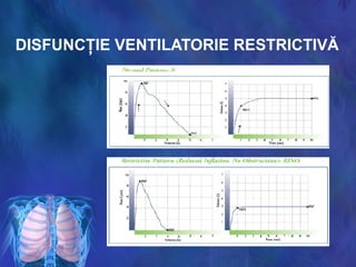 DISFUNCŢIE VENTILATORIE RESTRICTIVĂ
 