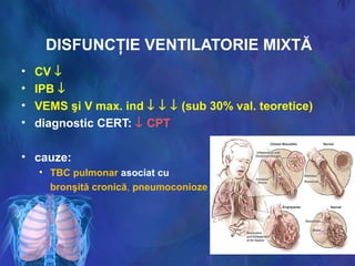 DISFUNCŢIE VENTILATORIE MIXTĂ
• CV ↓
• IPB ↓
• VEMS şi V max. ind ↓ ↓ ↓ (sub 30% val. teoretice)
• diagnostic CERT: ↓ CPT
• cauze:
• TBC pulmonar asociat cu
bronşită cronică, pneumoconioze
 