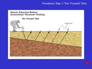 Procedure: Step 1; The “Forward” Shot.
 