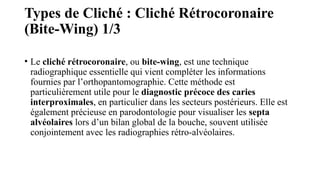 Types de Cliché : Cliché Rétrocoronaire
(Bite-Wing) 1/3
• Le cliché rétrocoronaire, ou bite-wing, est une technique
radiographique essentielle qui vient compléter les informations
fournies par l’orthopantomographie. Cette méthode est
particulièrement utile pour le diagnostic précoce des caries
interproximales, en particulier dans les secteurs postérieurs. Elle est
également précieuse en parodontologie pour visualiser les septa
alvéolaires lors d’un bilan global de la bouche, souvent utilisée
conjointement avec les radiographies rétro-alvéolaires.
 