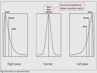 Normality - Examples
                                                                                                     Graphically
                       Normal Q-Q Plot of Height
                  3



                  2



                  1



                  0
                                                                                 Detrended Normal Q-Q Plot of Height
Expected Normal




                  -1                                                        .6


                                                                            .5
                  -2
                                                                            .4

                  -3                                                        .3
                   130             140     150     160   170
                                                                            .2
                       Observed Value
                                                         Dev from Normal

                                                                            .1


                                                                           0.0


                                                                           -.1

                                                                           -.2
                                                                             130             140        150     160     170


                                                                                 Observed Value    ©drtamil@gmail.com 2012
 