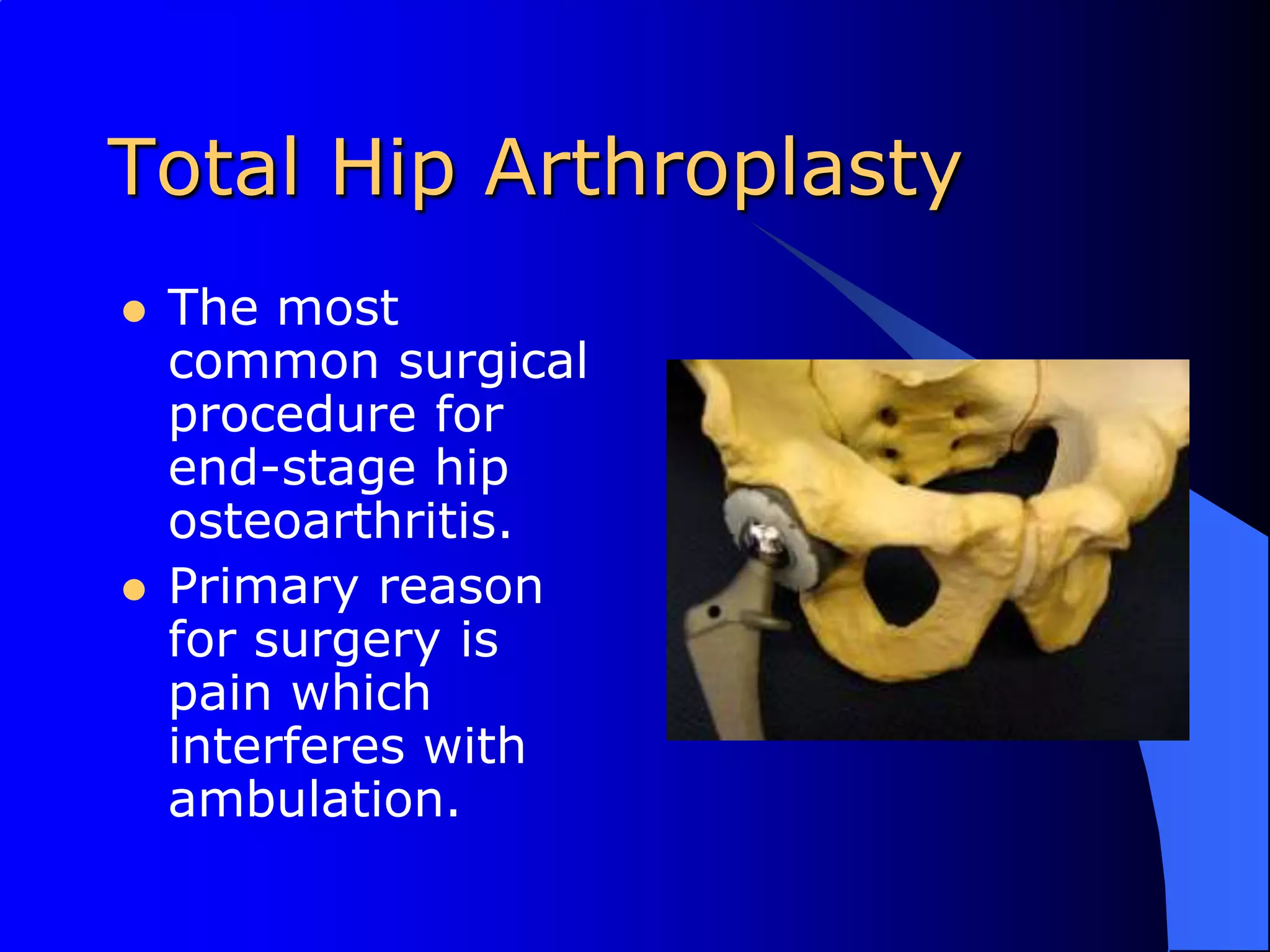 Total Hip ArthroplastyThe most common surgical procedure for end-stage hip osteoarthritis.Primary reason for surgery is pain which interferes with ambulation.