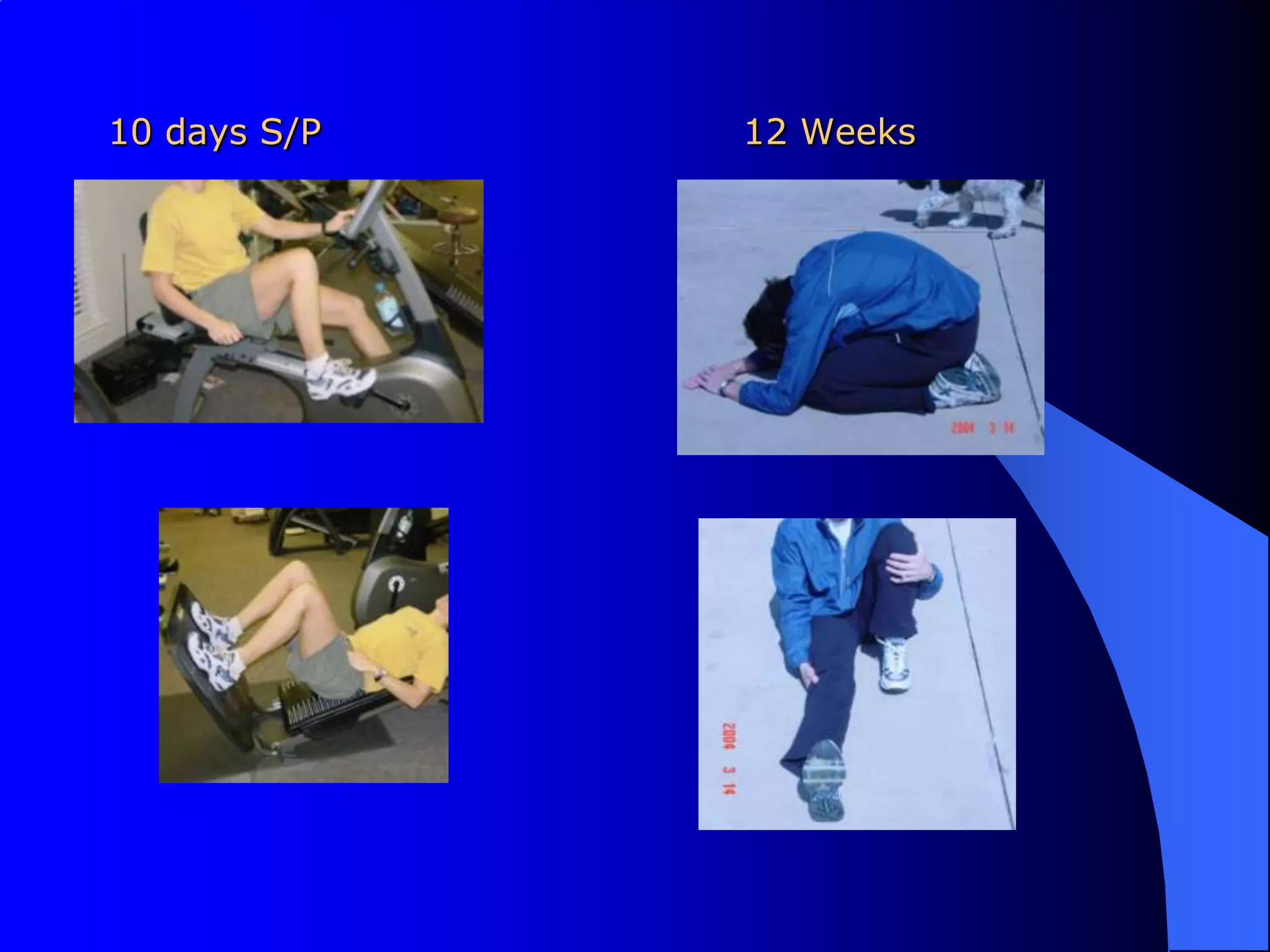 10 days S/P				12 Weeks