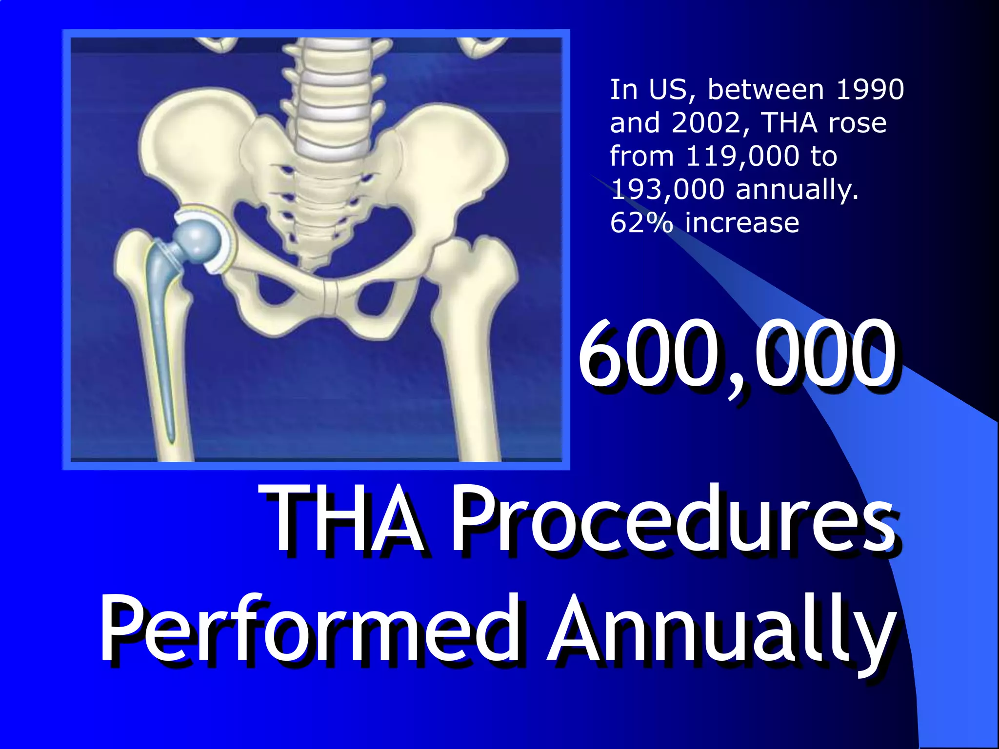 In US, between 1990 and 2002, THA rose from 119,000 to 193,000 annually.62% increase600,000 THA Procedures Performed Annually
