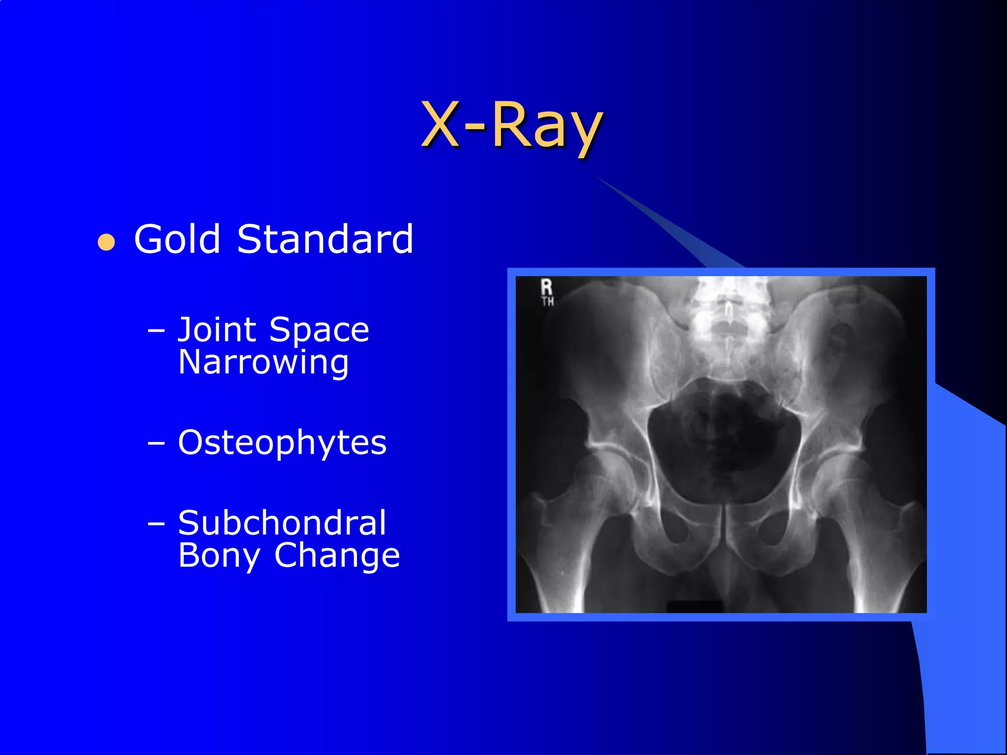 X-RayGold StandardJoint Space NarrowingOsteophytesSubchondral Bony Change