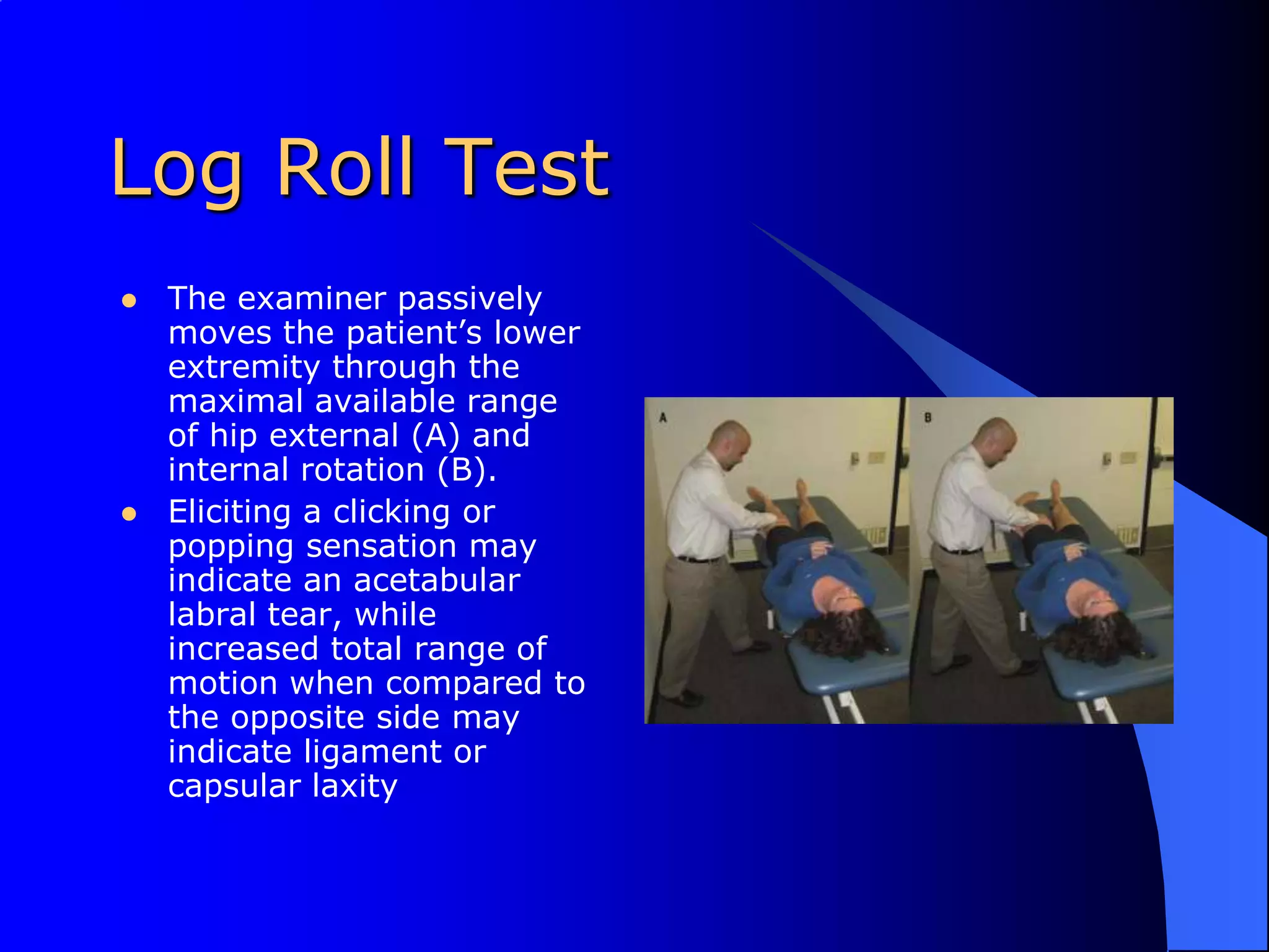 Log Roll TestThe examiner passively moves the patient’s lower extremity through the maximal available range of hip external (A) and internal rotation (B).Eliciting a clicking or popping sensation may indicate an acetabular labral tear, while increased total range of motion when compared to the opposite side may indicate ligament or capsular laxity