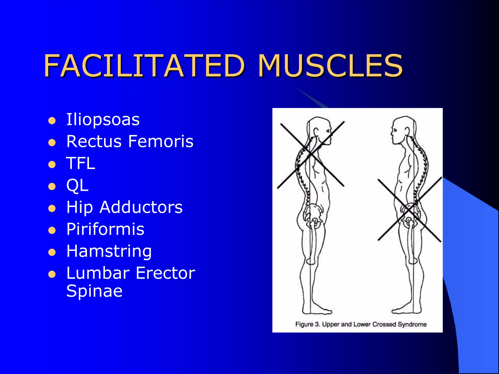FACILITATED MUSCLESIliopsoasRectus FemorisTFLQLHip AdductorsPiriformisHamstringLumbar Erector Spinae