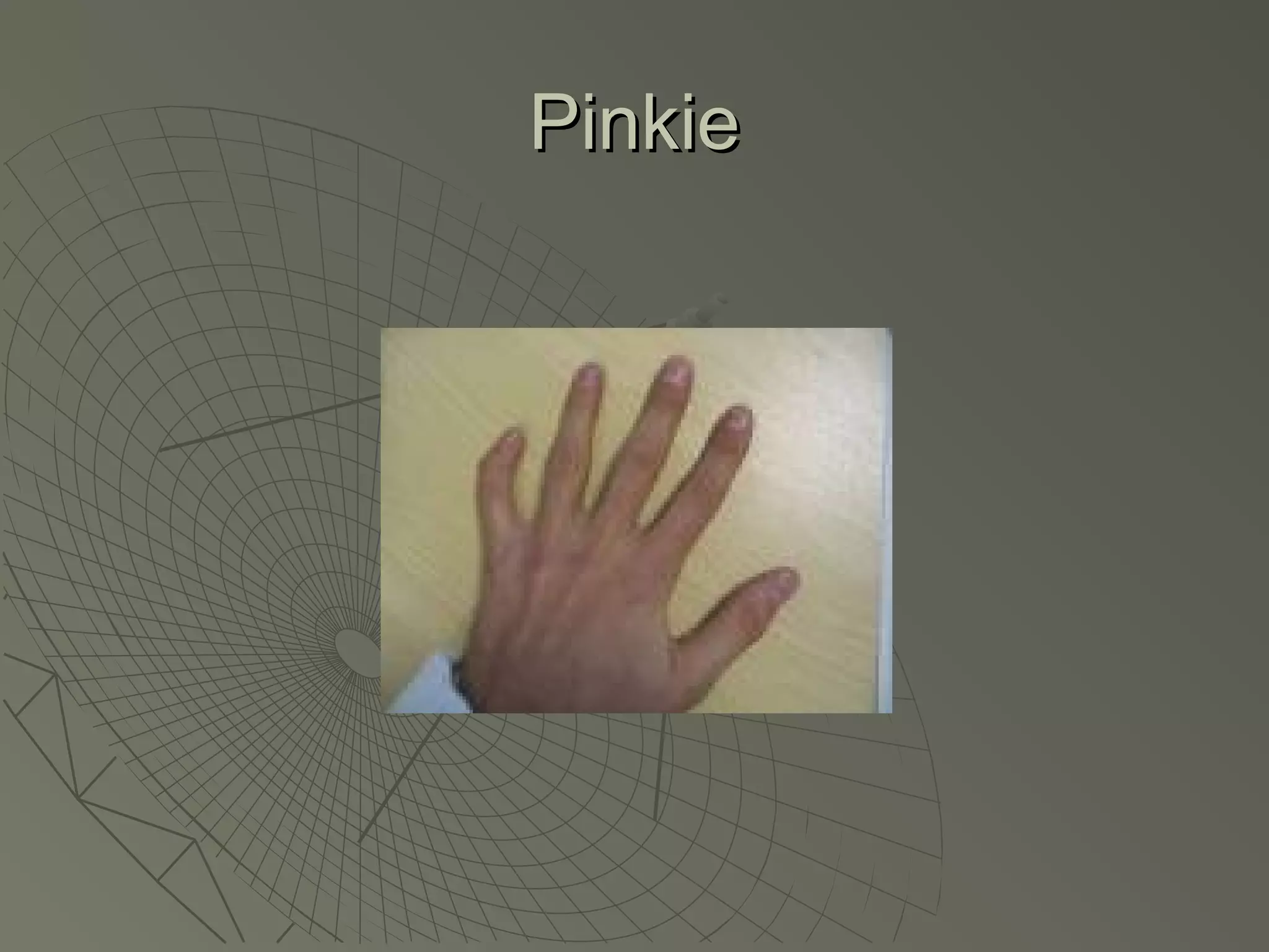 Pinkie
 