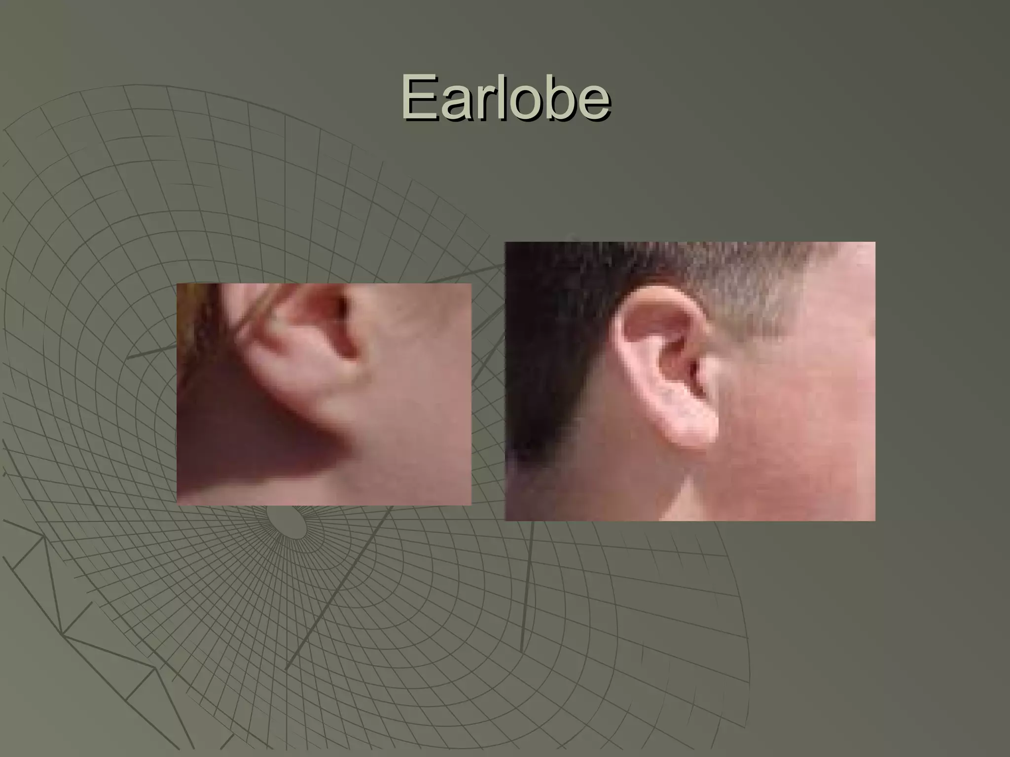 Earlobe
 