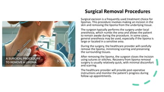 Exploring Lipoma Reasons - Causes, Symptoms, and Treatments.pdf