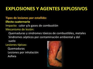 EXPLOSIONES Y AGENTES EXPLOSIVOS 
Tipos de lesiones por estallido: 
Efecto cuaternario 
Impacto: calor y/o gases de combustión 
Mecanismo de lesión: 
Quemaduras y síndromes tóxicos de combustibles, metales 
Síndromes sépticos por contaminación ambiental y del 
suelo 
Lesiones típicas: 
Quemaduras 
Lesiones por inhalación 
Asfixia 
 