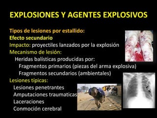 EXPLOSIONES Y AGENTES EXPLOSIVOS 
Tipos de lesiones por estallido: 
Efecto secundario 
Impacto: proyectiles lanzados por la explosión 
Mecanismo de lesión: 
Heridas balísticas producidas por: 
Fragmentos primarios (piezas del arma explosiva) 
Fragmentos secundarios (ambientales) 
Lesiones típicas: 
Lesiones penetrantes 
Amputaciones traumaticas 
Laceraciones 
Conmoción cerebral 
 
