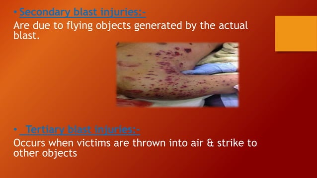 Explosive injuries ppt by himasri reddy | PPTX | First Aid | Injuries