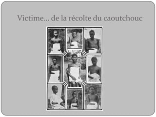 Victime… de la récolte du caoutchouc  