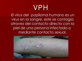 VPH El virus del  papiloma humano es un virus en la sangre, este se contagia atravez del contacto directo con la piel de una persona infectada o  mediante contacto sexual. 