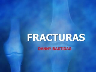 FRACTURAS
DANNY BASTIDAS

 