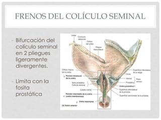 FRENOS DEL COLÍCULO SEMINAL
- Bifurcación del
colículo seminal
en 2 pliegues
ligeramente
divergentes.
- Limita con la
fosita
prostática
 