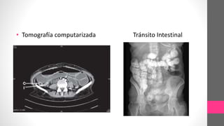 • Tomografía computarizada Tránsito Intestinal
 