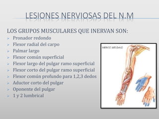 LESIONES NERVIOSAS DEL N.M
LOS GRUPOS MUSCULARES QUE INERVAN SON:
 Pronador redondo
 Flexor radial del carpo
 Palmar largo
 Flexor común superficial
 Flexor largo del pulgar ramo superficial
 Flexor corto del pulgar ramo superficial
 Flexor común profundo para 1,2,3 dedos
 Aductor corto del pulgar
 Oponente del pulgar
 1 y 2 lumbrical
 
