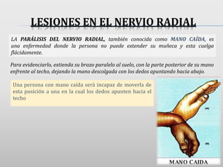 LESIONES EN EL NERVIO RADIAL
Una persona con mano caída será incapaz de moverla de
esta posición a una en la cual los dedos apunten hacia el
techo
LA PARÁLISIS DEL NERVIO RADIAL, también conocida como MANO CAÍDA, es
una enfermedad donde la persona no puede extender su muñeca y esta cuelga
flácidamente.
Para evidenciarlo, extienda su brazo paralelo al suelo, con la parte posterior de su mano
enfrente al techo, dejando la mano descolgada con los dedos apuntando hacia abajo.
 