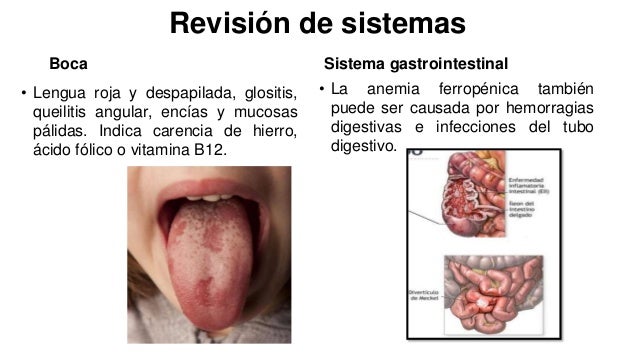 Cuidados de enfermería al paciente con anemia ferropénica