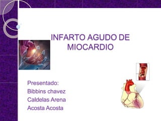 INFARTO AGUDO DE
MIOCARDIO
Presentado:
Bibbins chavez
Caldelas Arena
Acosta Acosta
 