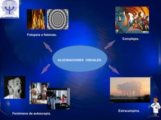 ALUCINACIONES VISUALES.
Fotopsia o fotomas.
Complejas.
Fenómeno de autoscopia.
Extracampina.
 