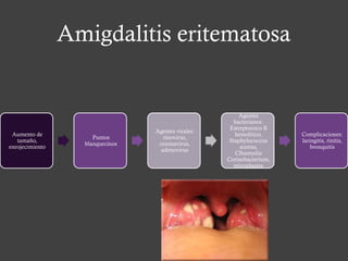 Amigdalitis eritematosa
Aumento de
tamaño,
enrojecimiento
Puntos
blanquecinos
Agentes virales:
rinovirus,
coronavirus,
adenovirus
Agentes
bacterianos:
Estreptococo B
hemolítico,
Staphylococcus
aureus,
Clhamydia
Corinebacterium,
micoplasma
Complicaciones:
laringitis, rinitis,
bronquitis
 