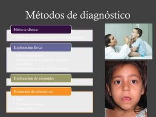 Métodos de diagnóstico
• AHF de cuadros amigdalinos o adenopatías
Historia clínica
• Fascie adenoidea
• Anormalidad en relación maxilar-
mandíbula
• Alteraciones en la oclusión dental
Exploración física
Exploración de adenoides
• BHC
• Exudado faríngeo
• Hemocultivo
Exámenes de laboratorio
 