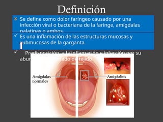 Definición
Se define como dolor faríngeo causado por una
infección viral o bacteriana de la faringe, amígdalas
palatinas o ambos.
 Es una inflamación de las estructuras mucosas y
submucosas de la garganta.
 Predisposición a la inflamación e infección por su
abundante contenido de tejido
 