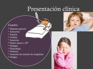 Presentación clínica
Cuadro
• Malestar general
• Adinamia
• Astenia
• Cefalea
• Anorexia
• Fiebre mayor a 30º
• Disfagia
• Odinofagia
• Disfonia
• Aumento de tamaño de amígdalas
• Otalgia
 