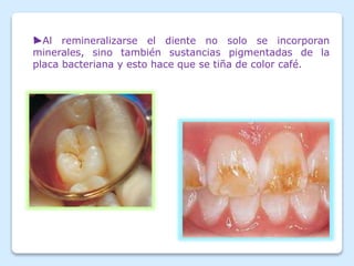 ►Al remineralizarse el diente no solo se incorporan
minerales, sino también sustancias pigmentadas de la
placa bacteriana y esto hace que se tiña de color café.
 