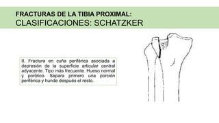 II. Fractura en cuña periférica asociada a
depresión de la superficie articular central
adyacente. Tipo más frecuente. Hueso normal
y porótico. Separa primero una porción
periférica y hunde después el resto.
FRACTURAS DE LA TIBIA PROXIMAL:
CLASIFICACIONES: SCHATZKER
 