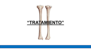 “TRATAMIENTO”
 