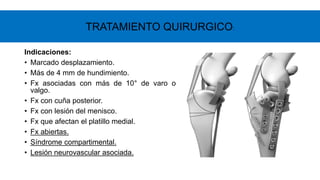Indicaciones:
• Marcado desplazamiento.
• Más de 4 mm de hundimiento.
• Fx asociadas con más de 10° de varo o
valgo.
• Fx con cuña posterior.
• Fx con lesión del menisco.
• Fx que afectan el platillo medial.
• Fx abiertas.
• Síndrome compartimental.
• Lesión neurovascular asociada.
TRATAMIENTO QUIRURGICO:
 